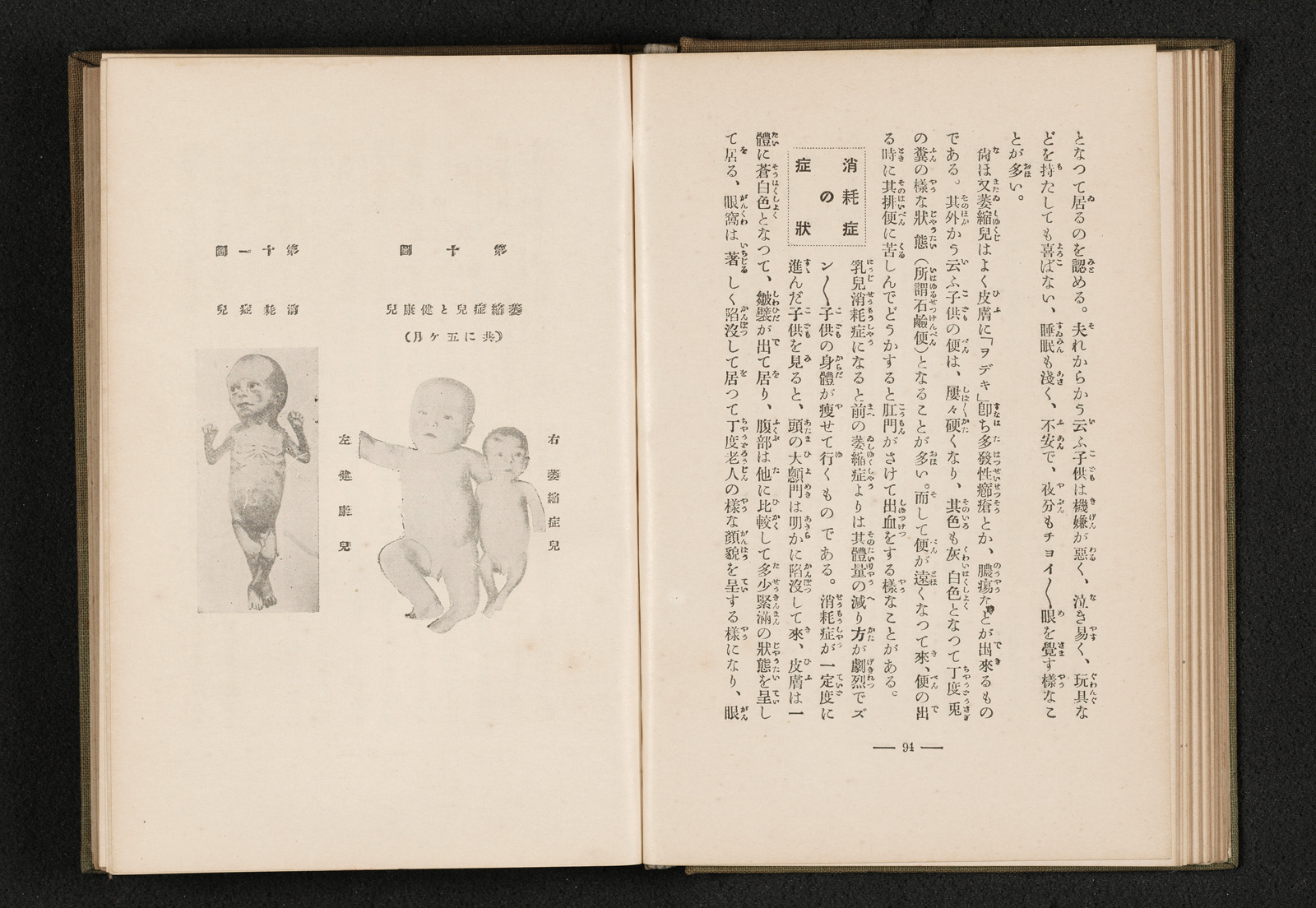 四季の小児病｜書籍・論文・その他刊行物｜一般社団法人 Jミルク