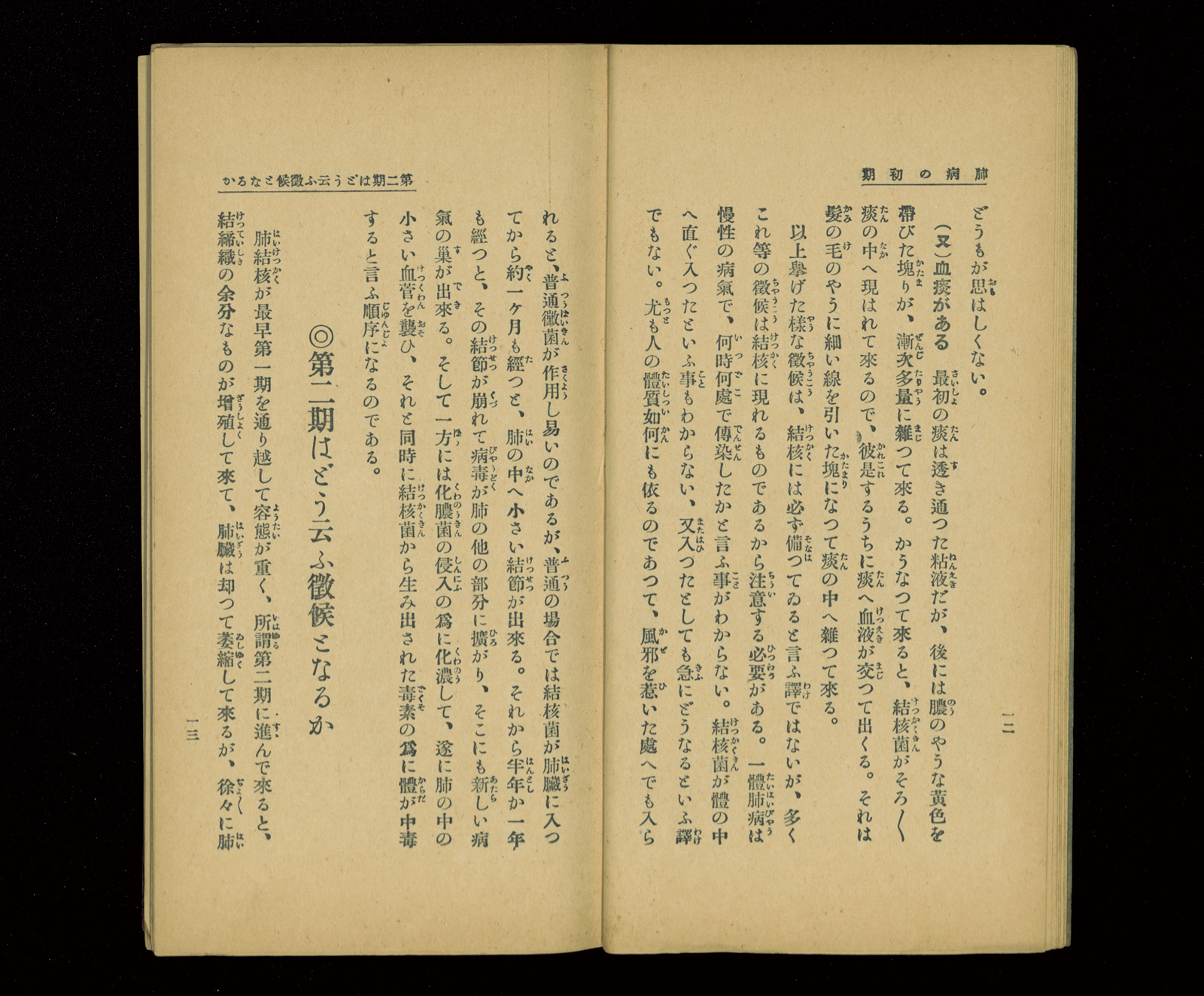 【現品限り】【入手困難】『結核患者の心理』 昭和33年発行 The scars of the atomic bomb remain in the 