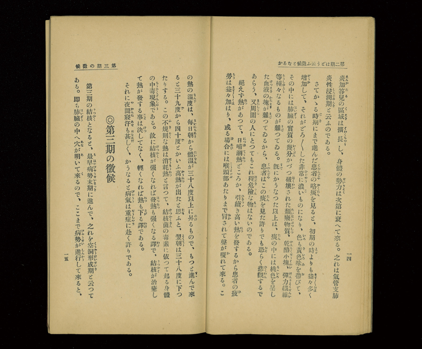 【現品限り】【入手困難】『結核患者の心理』 昭和33年発行 現品限り】【入手困難】『結核患者の心理』 昭和33年発行 現品限り